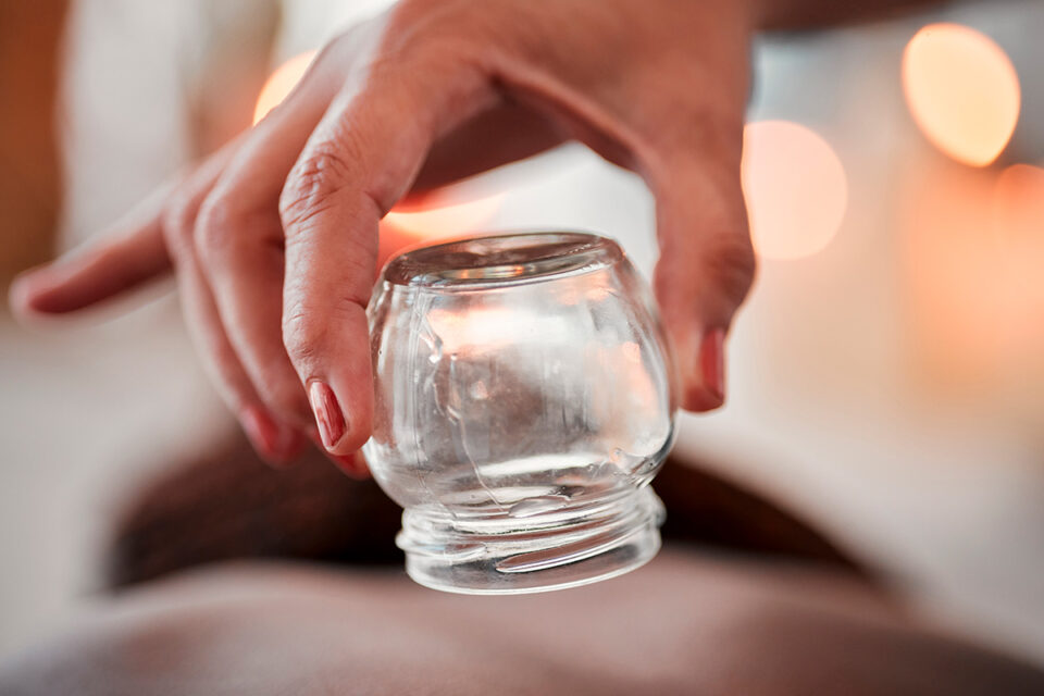 Cupping-bar-2